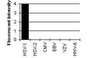 Cross Reactivity Results determined by IFA (HSV1 ICP4 anticorps)