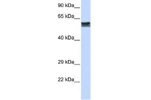 WB Suggested Anti-FYN Antibody Titration: 0. (FYN anticorps  (N-Term))
