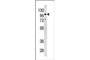 Image no. 1 for anti-Lethal Giant Larvae Homolog 2 (LLGL2) (N-Term) antibody (ABIN357639) (LLGL2 anticorps  (N-Term))