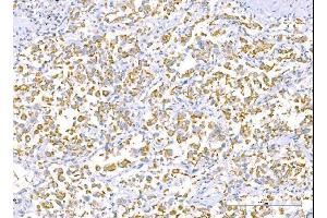 IHC analysis of RALBP1 using anti-RALBP1 antibody (ABIN7600800). (RALBP1 anticorps  (AA 239-506))