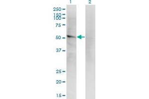 Western Blot analysis of LILRA2 expression in transfected 293T cell line by LILRA2 monoclonal antibody (M14), clone 4D7. (LILRA2 anticorps  (AA 1-466))
