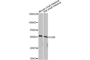 Western blot analysis of extracts of various cell lines, using CA9 Antibody. (CA9 anticorps)