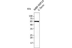 Western Blotting (WB) image for anti-SARS-CoV-2 Guanine-N7 Methyltransferase (NSP14) (ExoN) (C-Term) antibody (ABIN7273006) (SARS-CoV-2 NSP14 anticorps  (C-Term))