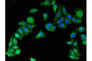 Immunofluorescent analysis of HepG2 cells using ABIN7171024 at dilution of 1:100 and Alexa Fluor 488-congugated AffiniPure Goat Anti-Rabbit IgG(H+L)