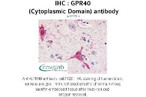 Image no. 1 for anti-Free Fatty Acid Receptor 1 (FFAR1) (1st Cytoplasmic Domain) antibody (ABIN1735088) (FFAR1 anticorps  (1st Cytoplasmic Domain))