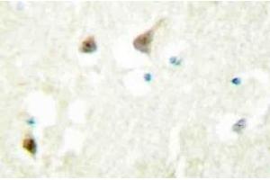 Immunohistochemistry (IHC) analyzes of hnRNP C1/C2 antibody in paraffin-embedded human brain tissue. (HNRNPC anticorps)