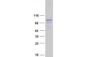 Validation with Western Blot