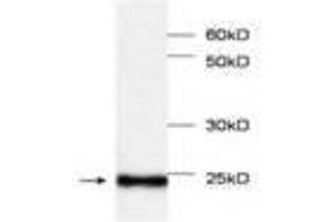 Image no. 1 for anti-Myoglobin (MB) antibody (ABIN791534) (Myoglobin anticorps)