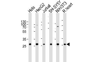 anti-VAMP (Vesicle-Associated Membrane Protein)-Associated Protein B and C (VAPB) (AA 126-139) antibody