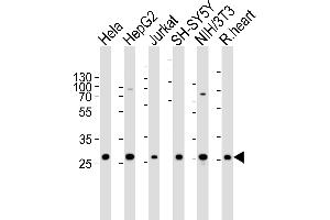 Western blot analysis of lysates from Hela, HepG2, Jurkat, SH-SY5Y, mouse NIH/3T3 cell line and rat heart tissue lysate(from left to right), using VB Antibody (Center) 20627c. (VAPB anticorps  (AA 126-139))