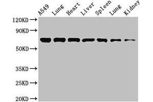 Western Blot Positive WB detected in: A549 whole cell lysate, Rat lung tissue, Mouse heart tissue, Mouse liver tissue, Mouse spleen tissue, Mouse lung tissue, Mouse kidney tissue All lanes: RPA1 antibody at 3. (RPA1 anticorps  (AA 2-616))