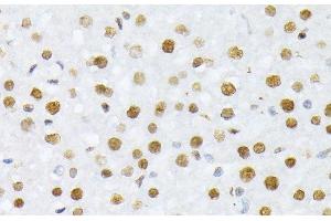 Immunohistochemistry of paraffin-embedded Rat liver using Phospho-Histone H2A(S129) Polyclonal Antibody at dilution of 1:100 (40x lens). (Histone H2A anticorps  (pSer129))