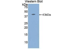 Western Blotting (WB) image for anti-Complement Component 8, beta Polypeptide (C8B) (AA 162-504) antibody (ABIN1858201) (C8B anticorps  (AA 162-504))