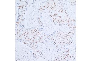 anti-Rad6 (N-Term) antibody