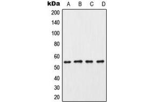 Western blot analysis of CK1 gamma 3 expression in HeLa (A), mouse testis (B), rat testis (C), PC12 (D) whole cell lysates. (CSNK1G3 anticorps  (C-Term))