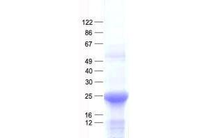 Validation with Western Blot
