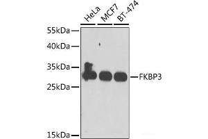 Western blot analysis of extracts of various cell lines using FKBP3 Polyclonal Antibody at dilution of 1:1000. (FKBP3 anticorps)