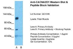 Host:  Rabbit  Target Name:  CACNA2D1  Sample Type:  Fetal Muscle  Lane A:  Primary Antibody  Lane B:  Primary Antibody + Blocking Peptide  Primary Antibody Concentration:  1ug/ml  Peptide Concentration:  5ug/ml  Lysate Quantity:  25ug/lane/Lane  Gel Concentration:  0. (CACNA2D1 anticorps  (Middle Region))