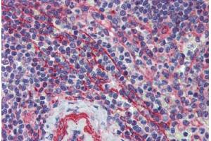 Spleen, Human: Formalin-Fixed, Paraffin-Embedded (FFPE) (MCTP1 anticorps  (C-Term))