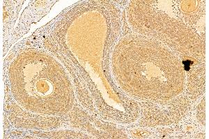 ABIN6265173 and ABIN6269300 at 1/100 staining Rat ovary tissue by IHC-P. (SMAD3 anticorps  (C-Term))