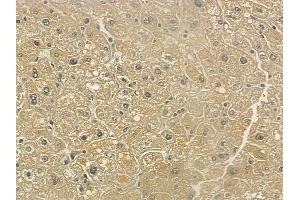 ABIN6261040 and ABIN6273217 at 1/100 staining human normal liver tissue by IHC-P. (CRLS1 anticorps  (Internal Region))