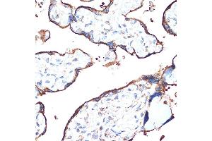 Immunohistochemistry of paraffin-embedded human placenta using CYPOR Rabbit mAb (ABIN7269151) at dilution of 1:100 (40x lens). (POR anticorps)