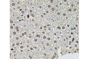 Immunohistochemistry of paraffin-embedded Mouse liver using PNKP Polyclonal Antibody at dilution of 1:100 (40x lens).