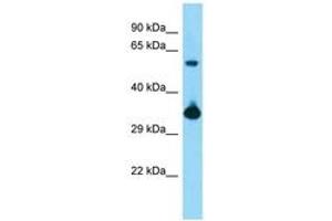Image no. 1 for anti-BMI1 Polycomb Ring Finger Oncogene (BMI1) (AA 181-230) antibody (ABIN6748382) (BMI1 anticorps  (AA 181-230))