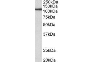 Western Blotting (WB) image for anti-Thyroid Peroxidase (TPO) (Internal Region) antibody (ABIN2464949) (Thyroperoxidase anticorps  (Internal Region))