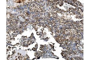 IHC analysis of Astrin/Deepest/SPAG5 using anti-Astrin/Deepest/SPAG5 antibody (ABIN7602399).