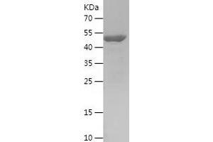 Western Blotting (WB) image for Cell Division Cycle 34 (CDC34) (AA 1-236) protein (His-IF2DI Tag) (ABIN7122229)