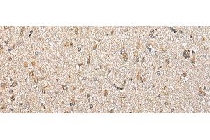 Immunohistochemistry of paraffin-embedded Human brain tissue using CSRP3 Polyclonal Antibody at dilution of 1:40(x200)