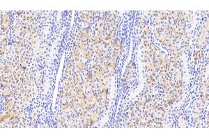 Detection of DDC in Human Kidney Tissue using Polyclonal Antibody to Dopa Decarboxylase (DDC) (DDC anticorps  (AA 200-420))