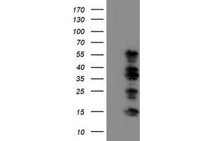 Western Blotting (WB) image for anti-WW Domain Containing Transcription Regulator 1 (WWTR1) antibody (ABIN1501763)