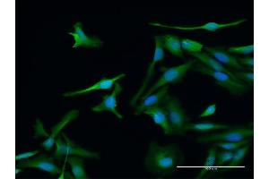 Immunofluorescence of purified MaxPab antibody to PSME1 on HeLa cell. (PSME1 anticorps  (AA 1-249))
