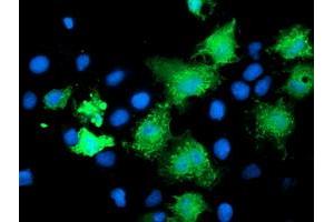 Anti-KATNB1 mouse monoclonal antibody (ABIN2455186) immunofluorescent staining of COS7 cells transiently transfected by pCMV6-ENTRY KATNB1 (RC201852). (KATNB1 anticorps)
