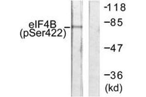 Western blot analysis of extracts from NIH-3T3 cells, using eIF4B (Phospho-Ser422) Antibody. (EIF4B anticorps  (pSer422))