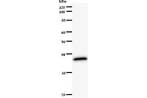 Western Blotting (WB) image for anti-Nei Endonuclease VIII-Like 3 (NEIL3) antibody (ABIN931131) (NEIL3 anticorps)