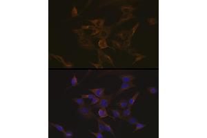 Immunofluorescence analysis of NIH-3T3 cells using EB3/M Rabbit mAb (ABIN7268535) at dilution of 1:100 (40x lens). (MAPRE3 anticorps)