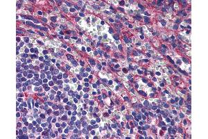 anti-Perilipin 3 (PLIN3) (AA 1-435) antibody