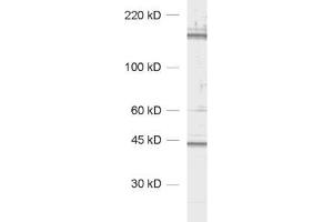 Western Blotting (WB) image for anti-CAP-GLY Domain Containing Linker Protein 1 (CLIP1) (AA 1283-1438) antibody (ABIN1742486) (CLIP1 anticorps  (AA 1283-1438))