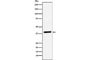 Western blot analysis of VEGFD expression in Caco-2 cell lysate.