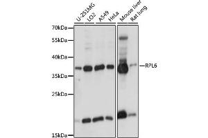 Western blot analysis of extracts of various cell lines, using RPL6 antibody. (RPL6 anticorps)