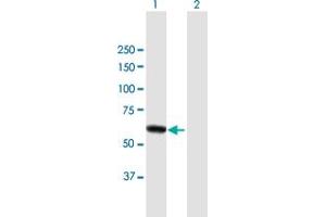 Western Blot analysis of DPYSL4 expression in transfected 293T cell line by DPYSL4 MaxPab polyclonal antibody. (DPYSL4 anticorps  (AA 1-572))