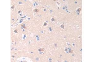 IHC-P analysis of brain tissue, with DAB staining. (Cathepsin W anticorps  (AA 22-376))