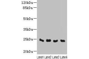 Western blot All lanes: C4orf33 antibody at 4 μg/mL Lane 1: Mouse kidney tissue Lane 2: Mouse liver tissue Lane 3: Mouse lung tissue Lane 4: Mouse heart tissue Secondary Goat polyclonal to rabbit IgG at 1/10000 dilution Predicted band size: 24 kDa Observed band size: 24 kDa (C4orf33 anticorps  (AA 1-199))