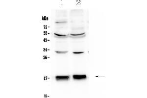 Western blot analysis of COX IV using anti-COX IV antibody .