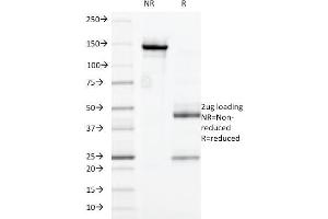 SDS-PAGE Analysis Purified CD32 Mouse Monoclonal Antibody (7.