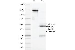 SDS-PAGE Analysis Purified CD32 Mouse Monoclonal Antibody (7. (FCGR2A anticorps)