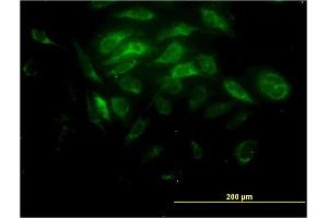 Immunofluorescence of monoclonal antibody to SYT11 on HeLa cell.